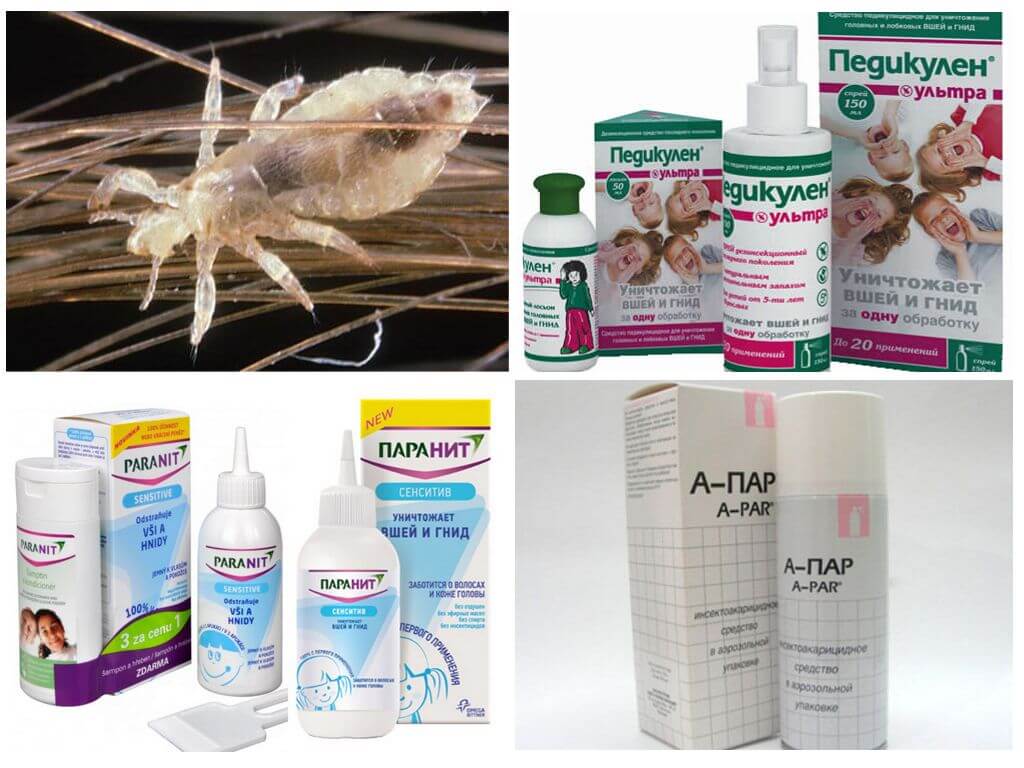 Rating of the best lice remedies in 2025