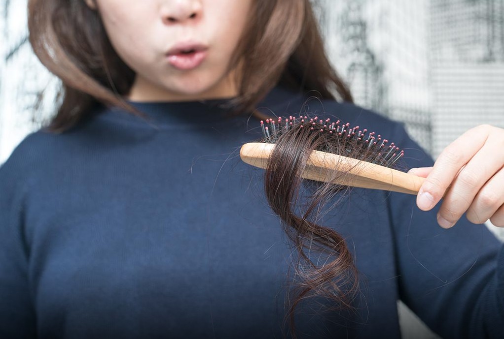 Les meilleurs traitements contre la perte de cheveux en 2025