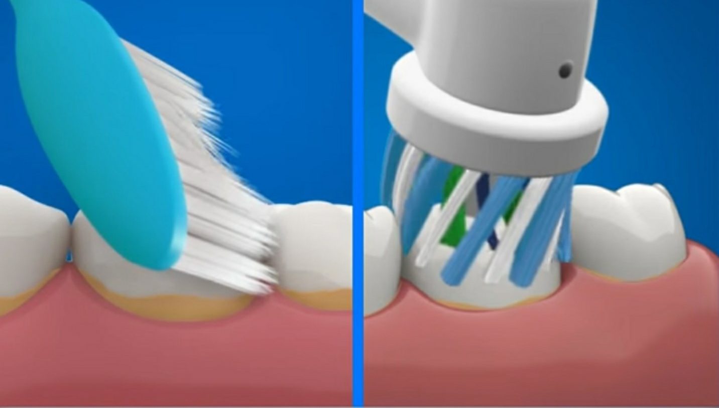 Classement des meilleures brosses à dents pour 2025