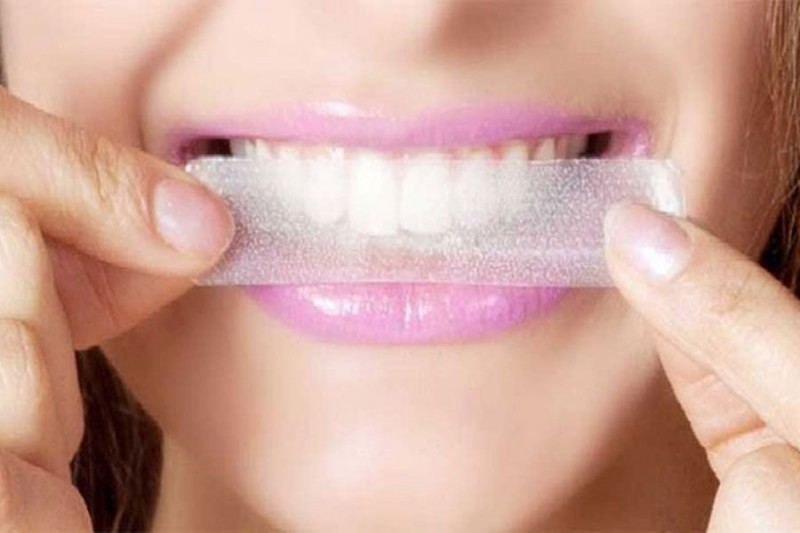 Top rated teeth whitening strips for 2025