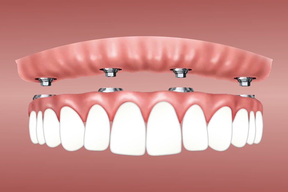 Classement des meilleures cliniques d'implants dentaires à Omsk pour 2025