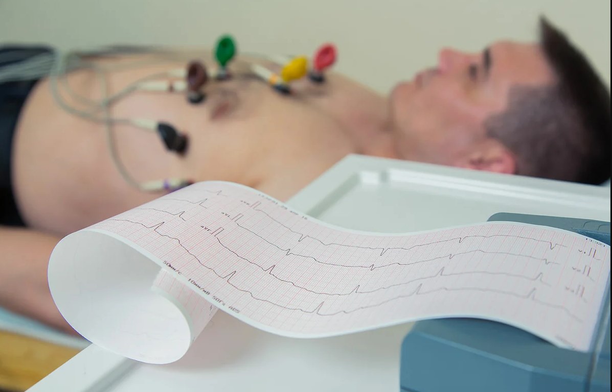 Classement des meilleurs électrocardiographes pour 2025