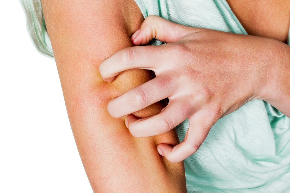 Rating of the best remedies for itchy skin for 2025