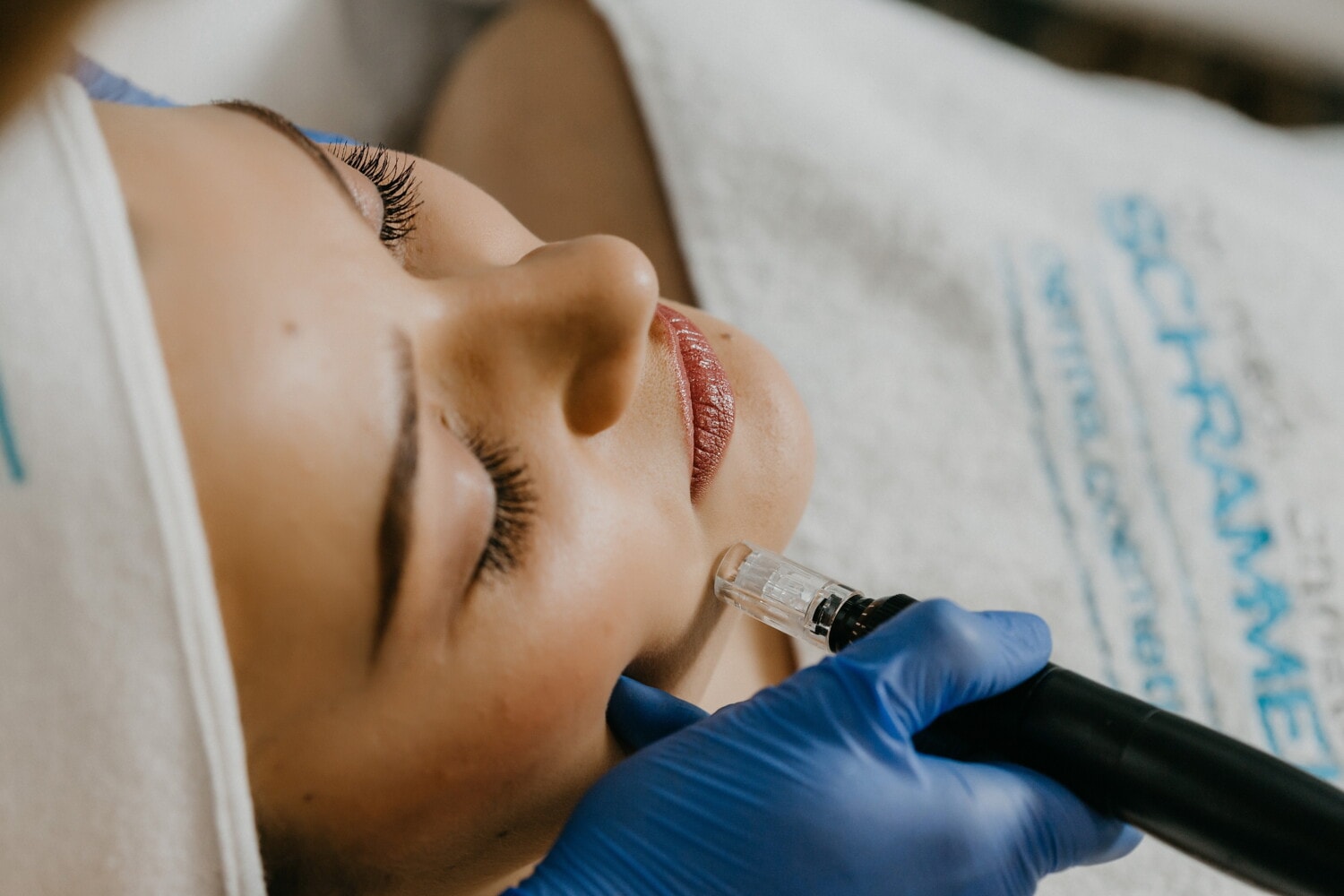 The best hardware technologies for facial rejuvenation and lifting for 2025