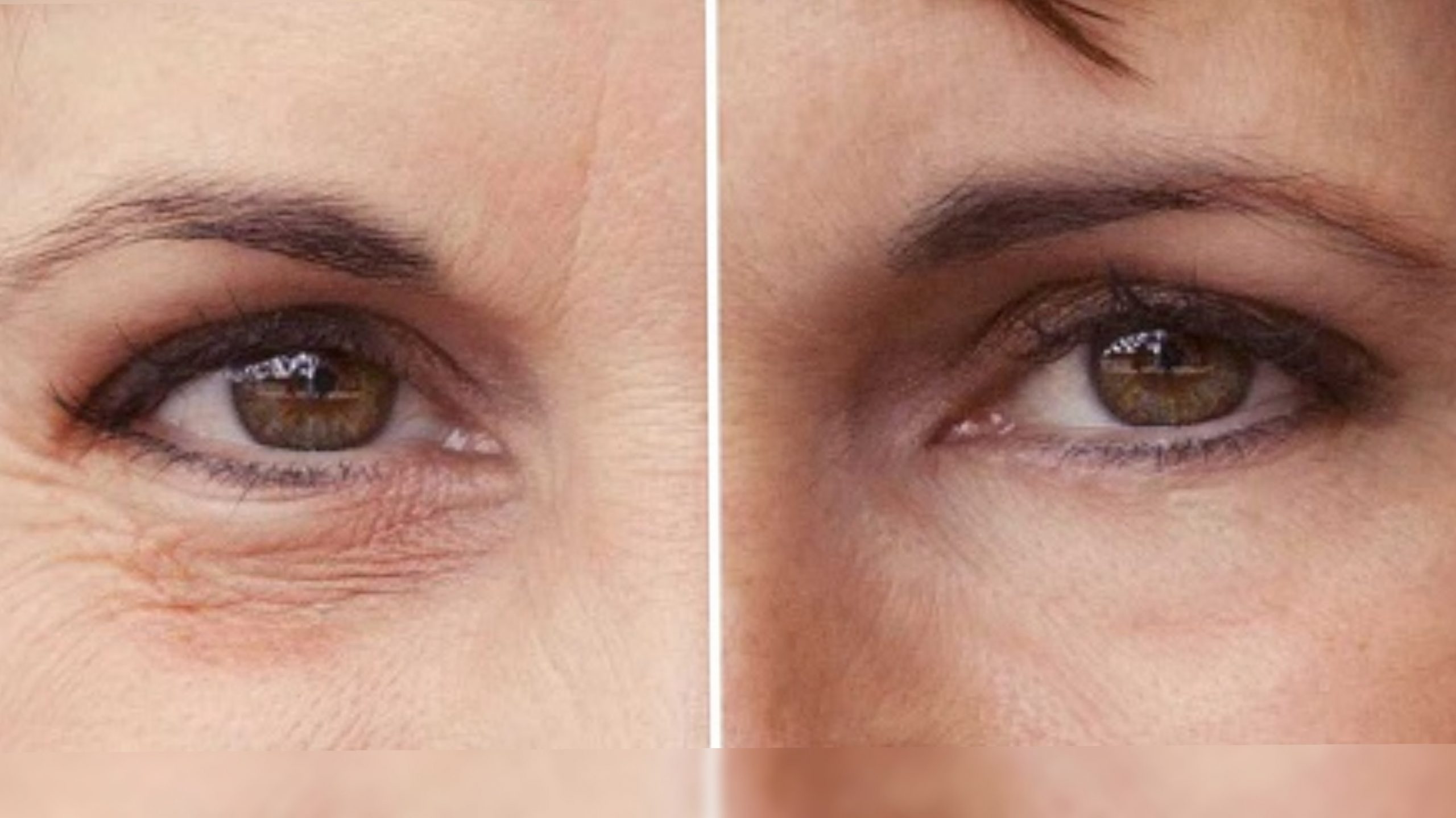 Ranking of the best creams for wrinkles around the eyes for 2025